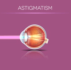 Chart Showing How Astigmatism Affects an Eye